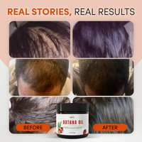 Holistic Depot Batana Oil