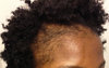 Thinning Edges